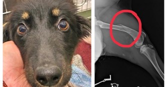 Die kleine Chiara hat ein gebrochene Bein